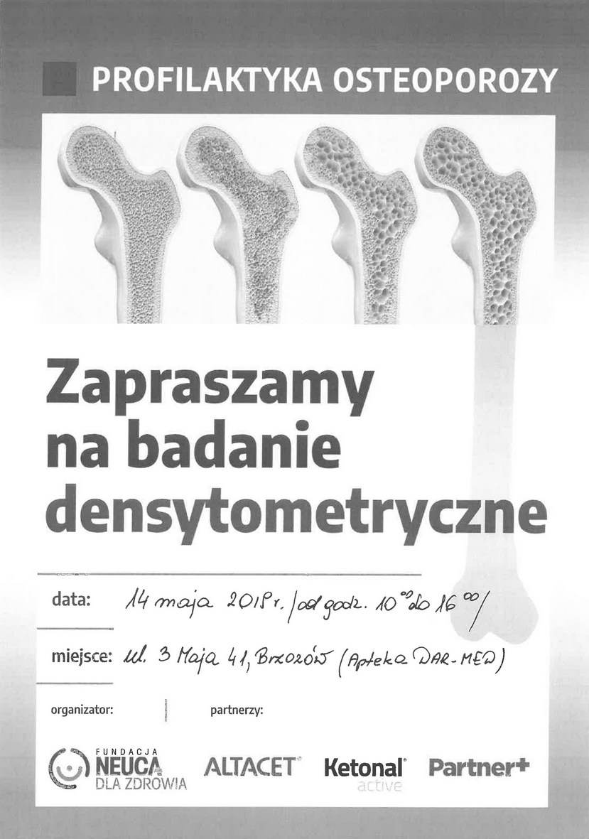 Badanie densytometryczne